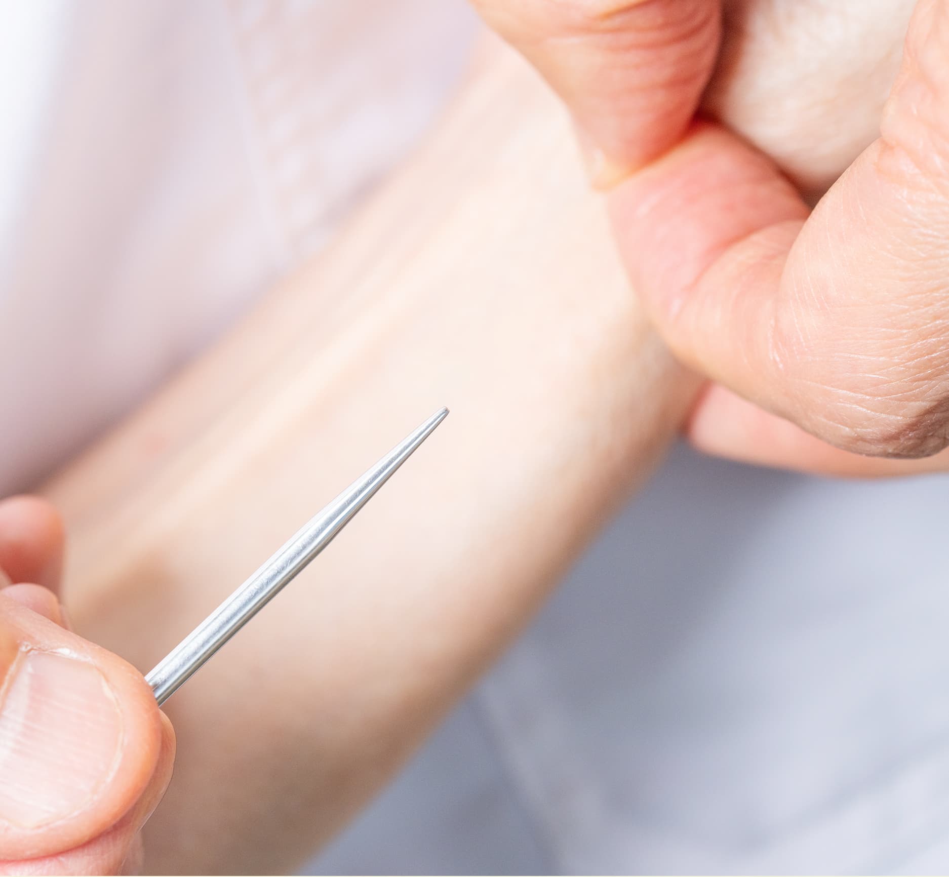 「刺さないはり」で根本の体質を改善