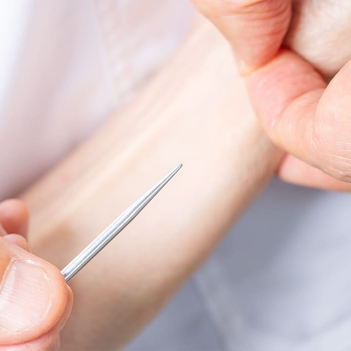体に優しい「痛くないはり・熱くないお灸」